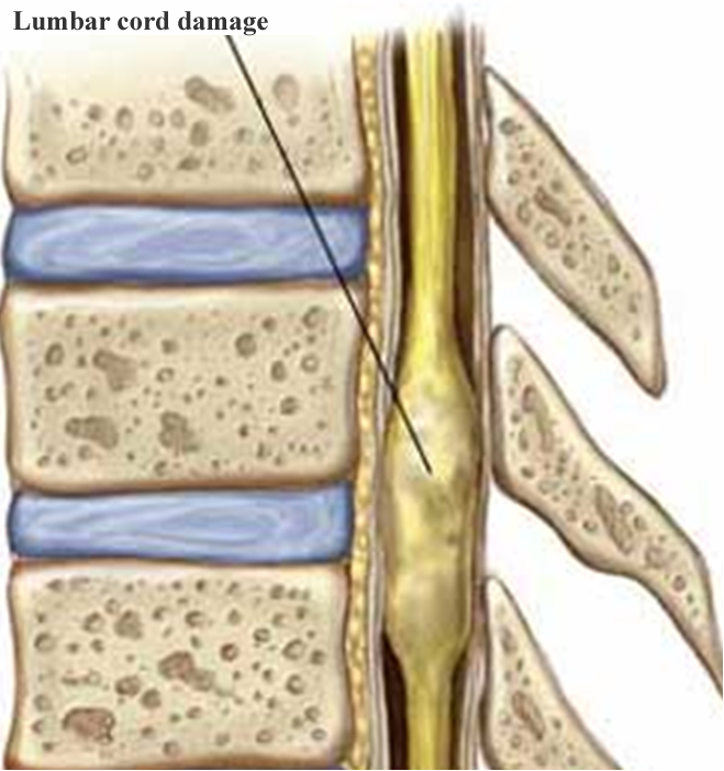 Std Vertebral Column Spinal Cord By Ms Bindu My Xxx Hot Girl