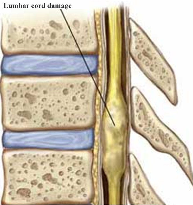 University Of Florida PHHP Muscle Physiology Laboratory Spinal 
